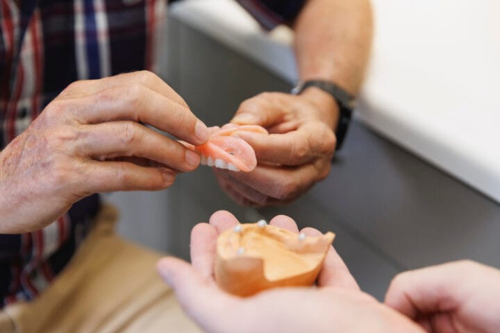 All-On-4 Implants