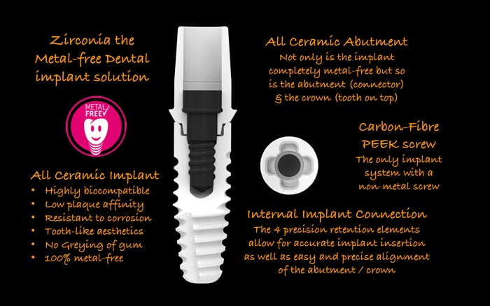 Zirconia metal-free implant