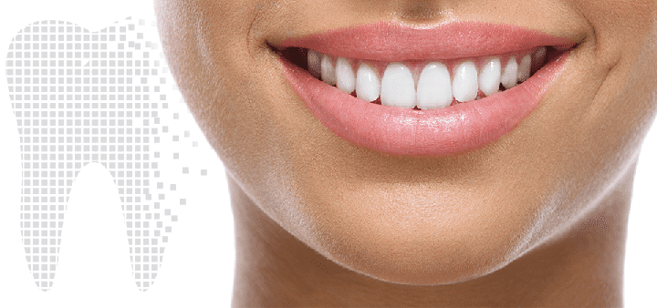 perfect smile with dental implants