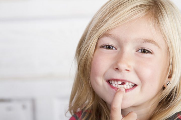 child missing tooth