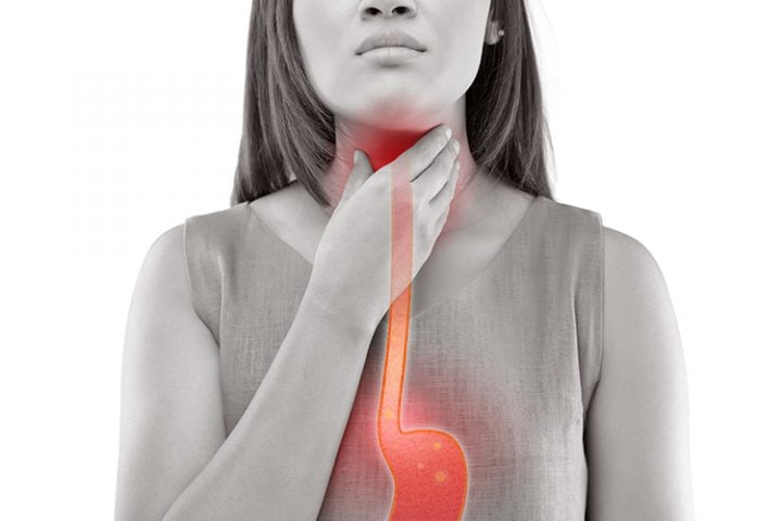 acid reflux and oral health