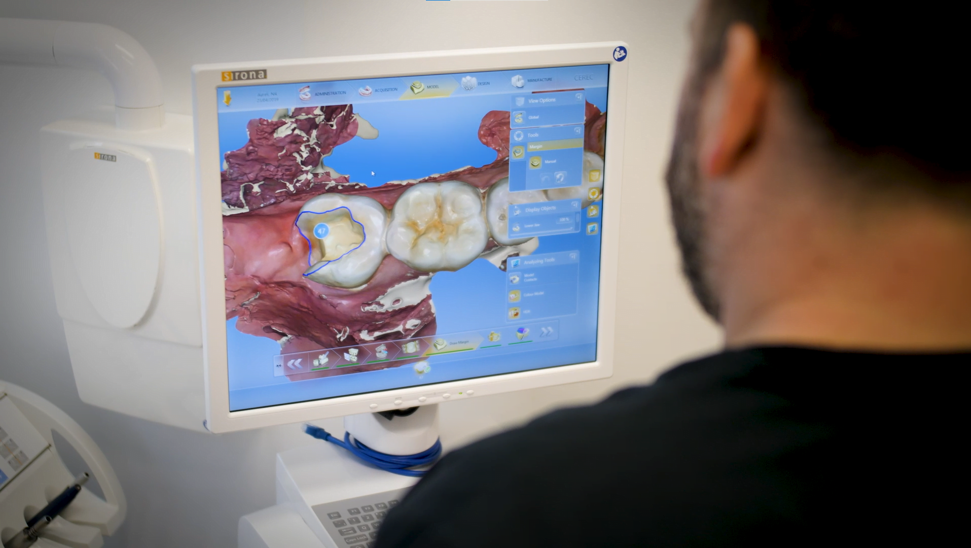 CEREC Dentistry Porcelain Veneers and Restorations Sydney SDAI