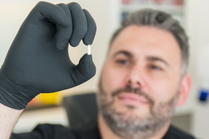 Am I a candidate for dental implants?